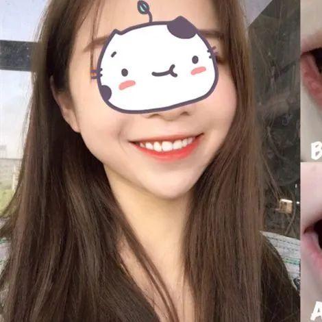 再生牙齿申报新成果揭晓