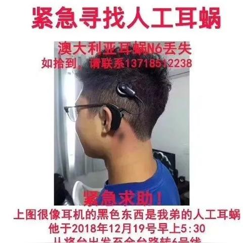 澳大利亚耳蜗N6最新价格解析